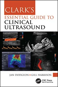 Clarks Essential Guide to Clinical Ultrasound 1st Edition_